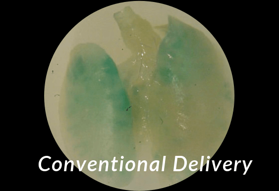 Conventional Delivery
